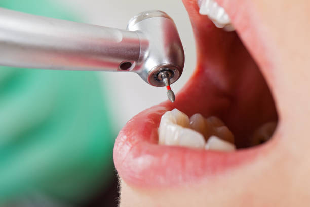 Best Dental Abscess Treatment in Hawthorne, NV